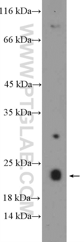 Western Blot (WB) analysis of HeLa cells using EXOSC1 Polyclonal antibody (12585-1-AP)