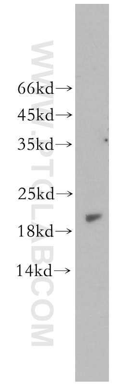 Western Blot (WB) analysis of human stomach tissue using EXOSC1 Polyclonal antibody (12585-1-AP)