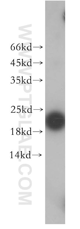 Western Blot (WB) analysis of SGC-7901 cells using EXOSC1 Polyclonal antibody (12585-1-AP)