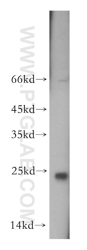 Western Blot (WB) analysis of HeLa cells using EXOSC1 Polyclonal antibody (12585-1-AP)