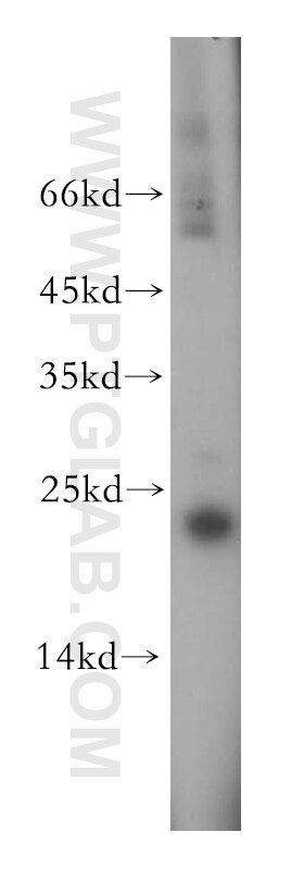 Western Blot (WB) analysis of Jurkat cells using EXOSC1 Polyclonal antibody (12585-1-AP)