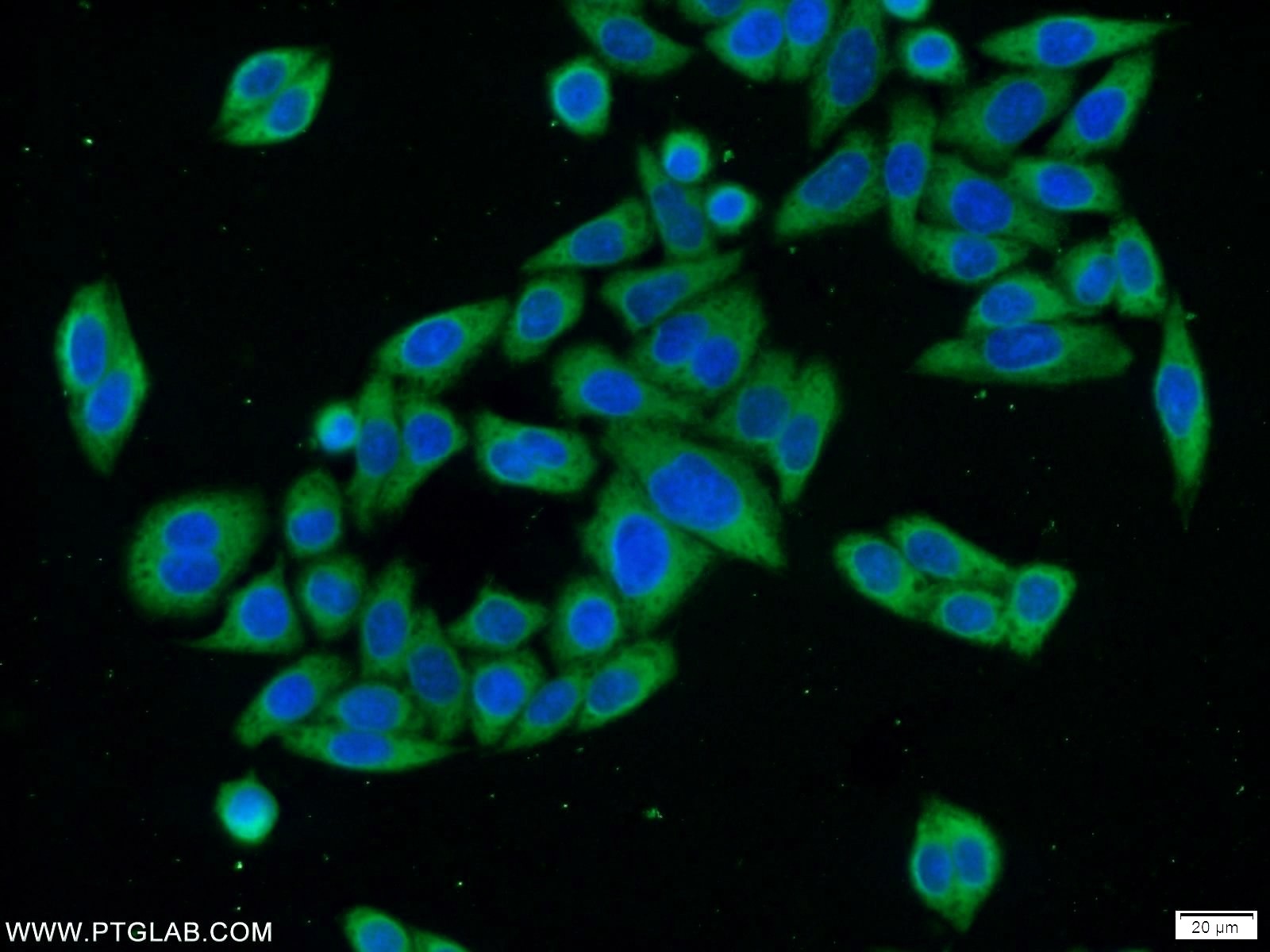 Immunofluorescence (IF) / fluorescent staining of HeLa cells using EXOSC10 Polyclonal antibody (16731-1-AP)
