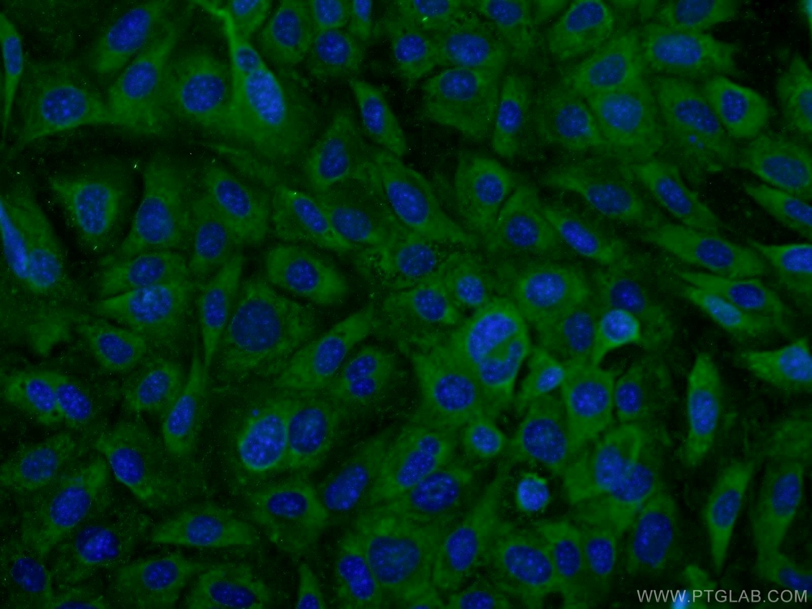 Immunofluorescence (IF) / fluorescent staining of NIH/3T3 cells using EXOSC10 Polyclonal antibody (16731-1-AP)