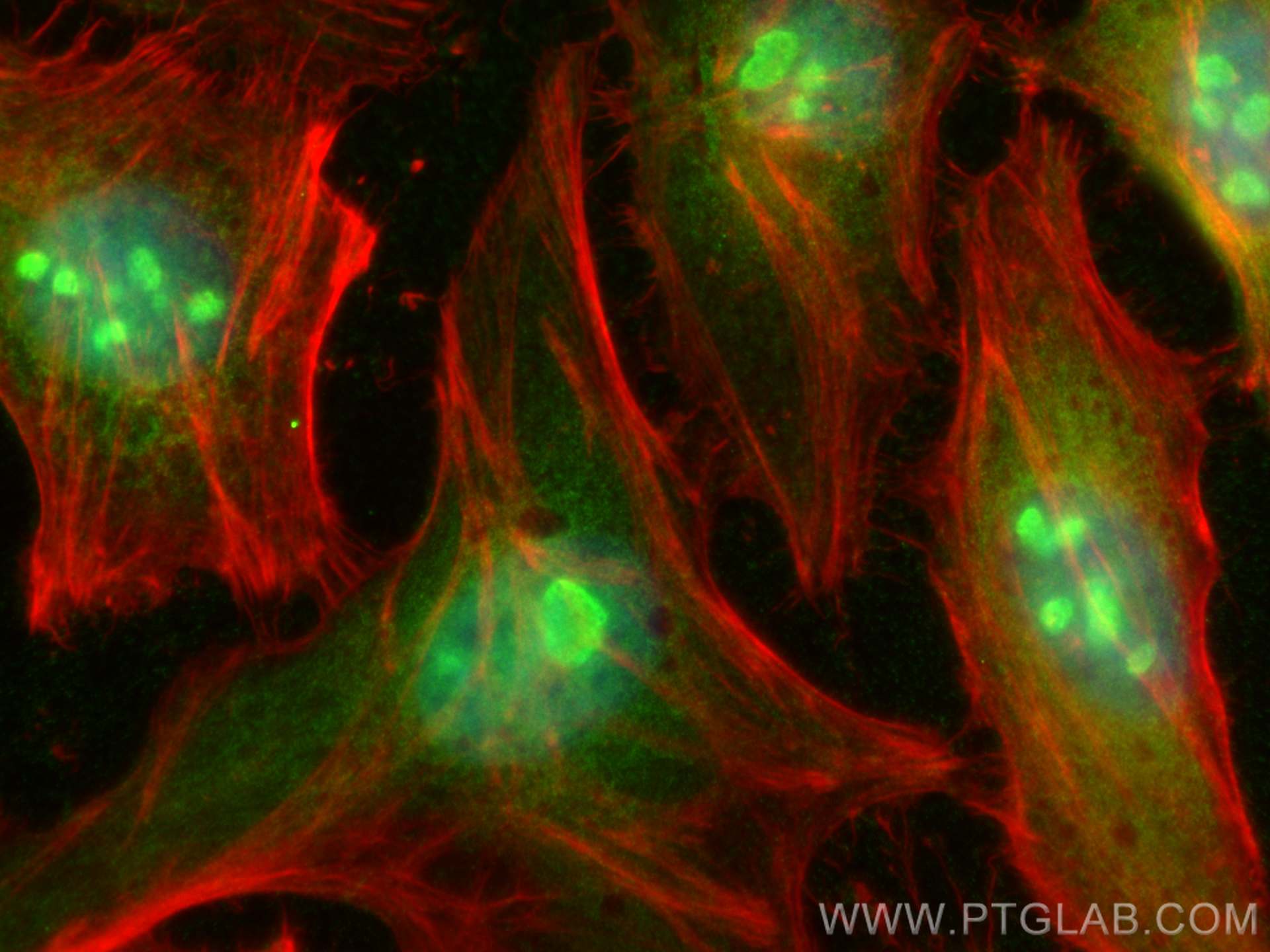 Immunofluorescence (IF) / fluorescent staining of HeLa cells using EXOSC10 Polyclonal antibody (16731-1-AP)