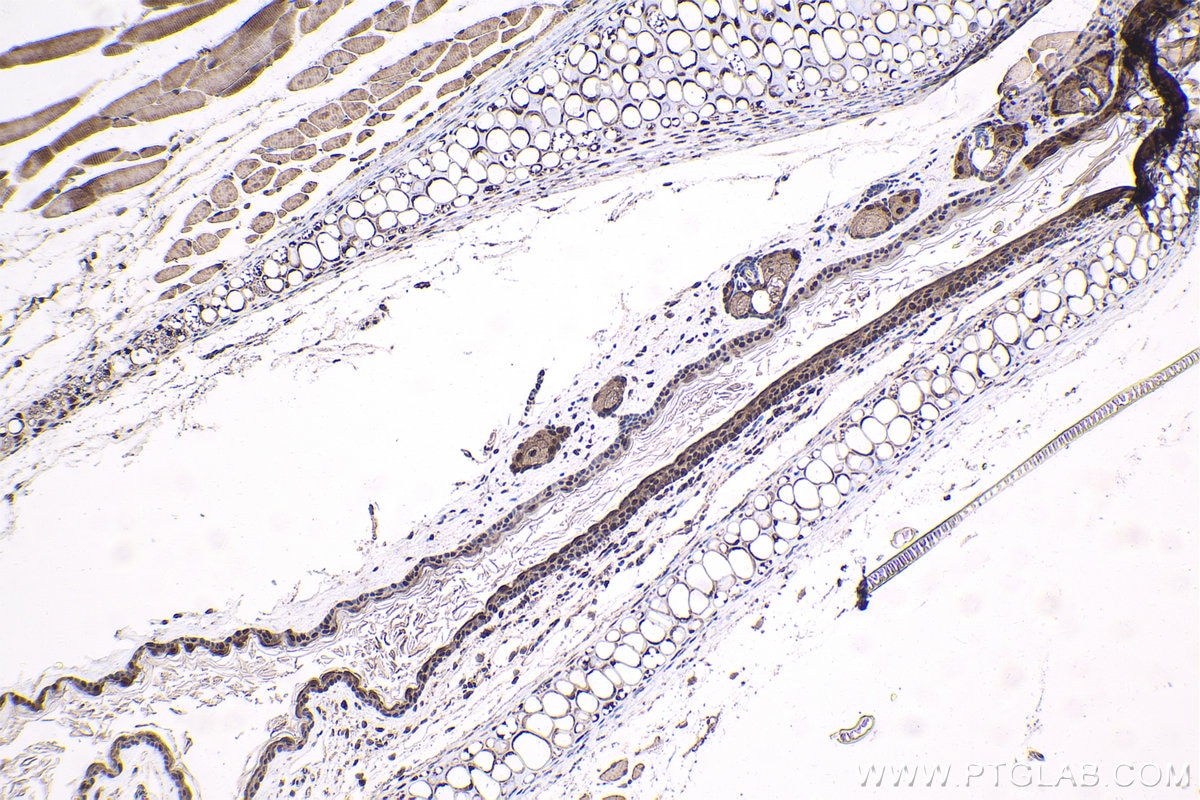 Immunohistochemistry (IHC) staining of mouse skin tissue using EXOSC10 Polyclonal antibody (16731-1-AP)