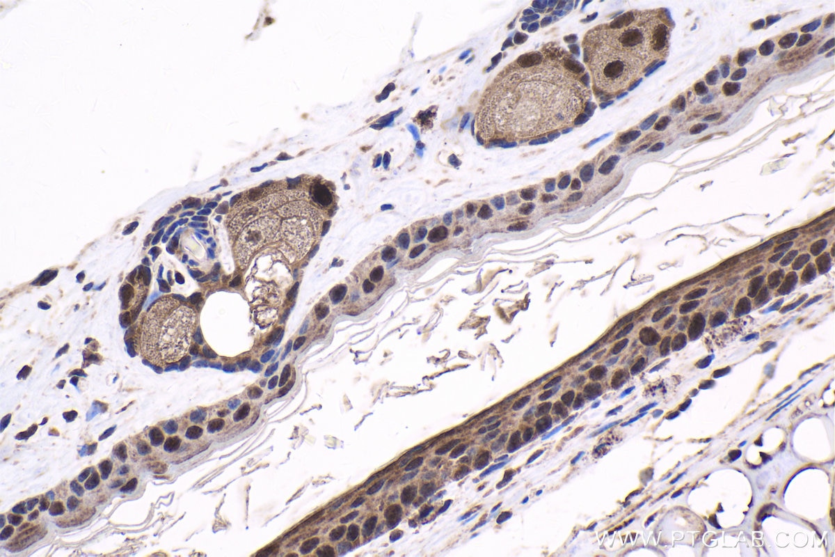 Immunohistochemistry (IHC) staining of mouse skin tissue using EXOSC10 Polyclonal antibody (16731-1-AP)