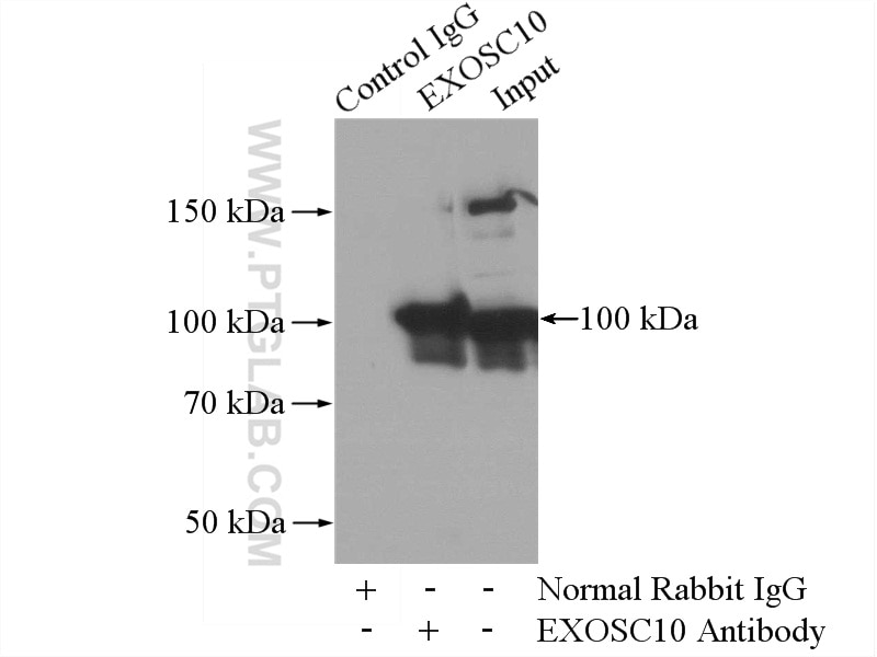 Immunoprecipitation (IP) experiment of HeLa cells using EXOSC10 Polyclonal antibody (16731-1-AP)