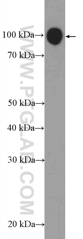 Western Blot (WB) analysis of mouse spleen tissue using EXOSC10 Polyclonal antibody (16731-1-AP)