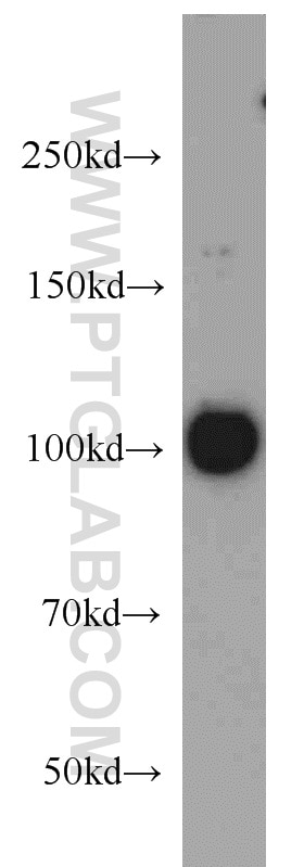 EXOSC10 Polyclonal antibody