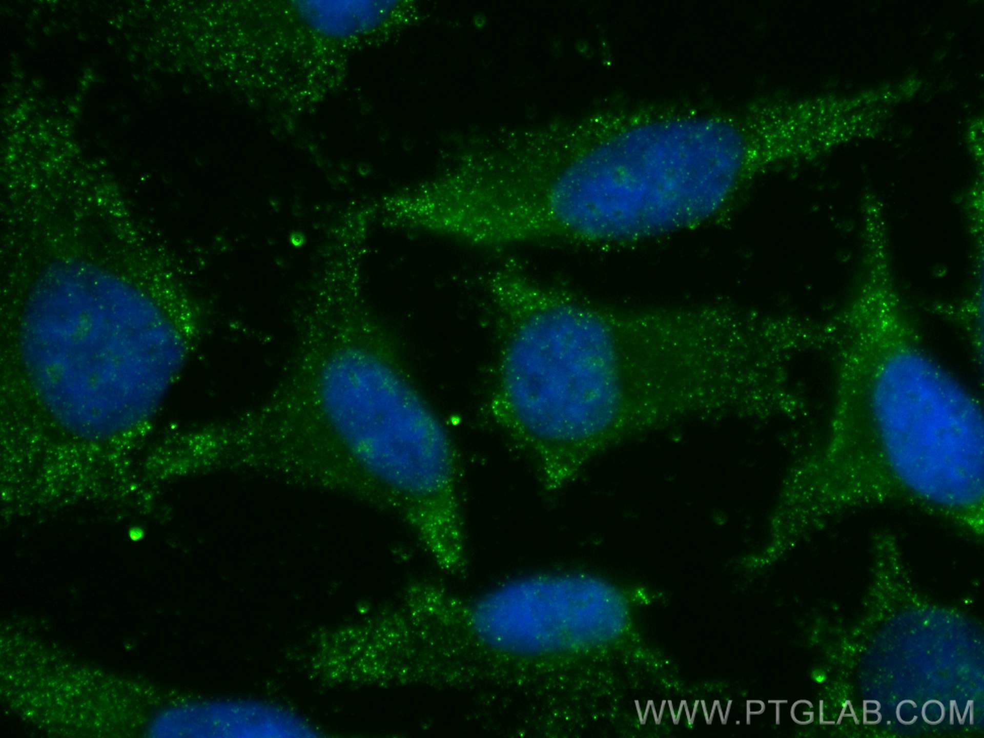 Immunofluorescence (IF) / fluorescent staining of HeLa cells using EXOSC10 Monoclonal antibody (68315-1-Ig)