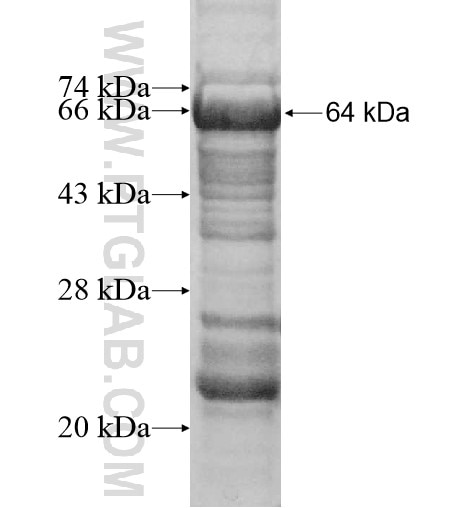 EXOSC10 fusion protein Ag10189 SDS-PAGE