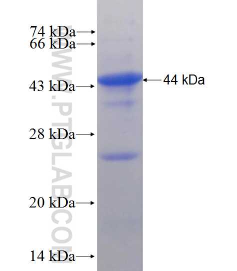 EXOSC10 fusion protein Ag10318 SDS-PAGE