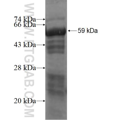 EXOSC10 fusion protein Ag1666 SDS-PAGE