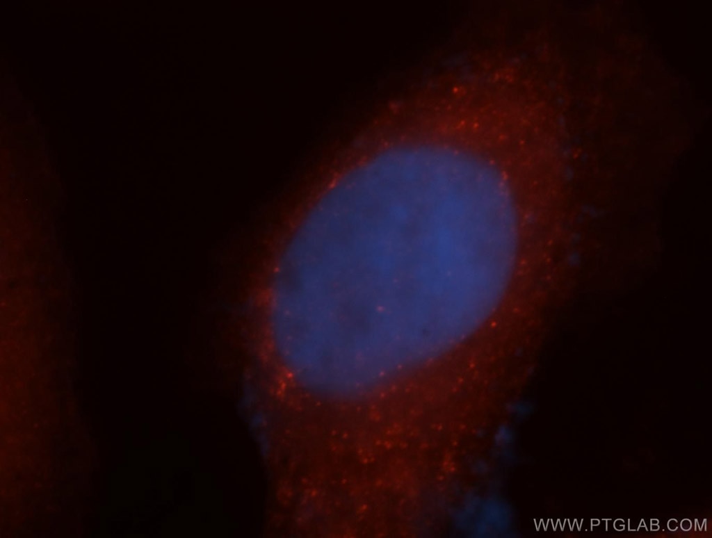 Immunofluorescence (IF) / fluorescent staining of MCF-7 cells using EXOSC2 Polyclonal antibody (14805-1-AP)