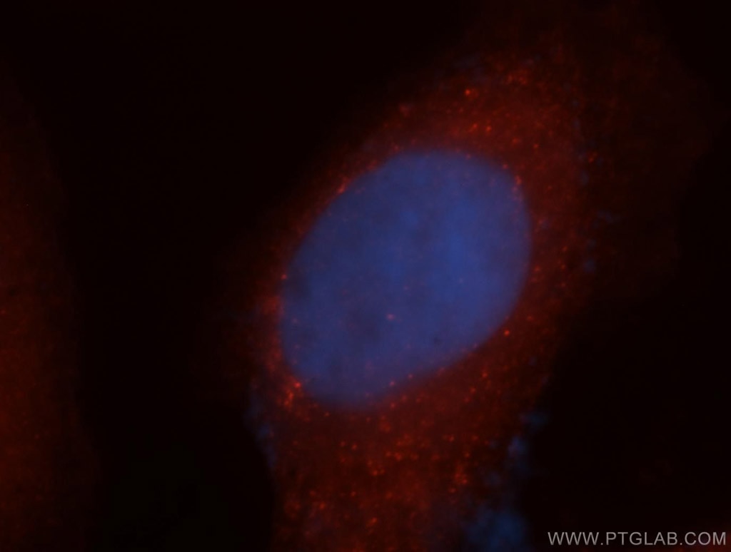 IF Staining of MCF-7 using 14805-1-AP