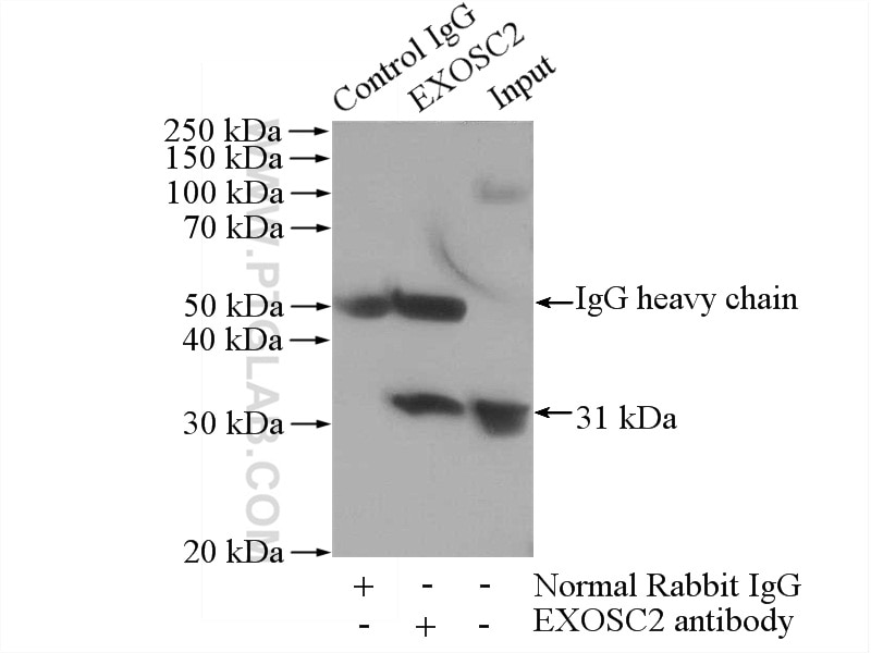 Immunoprecipitation (IP) experiment of HeLa cells using EXOSC2 Polyclonal antibody (14805-1-AP)