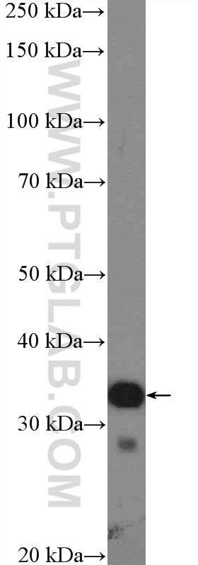 Western Blot (WB) analysis of HeLa cells using EXOSC2 Polyclonal antibody (14805-1-AP)