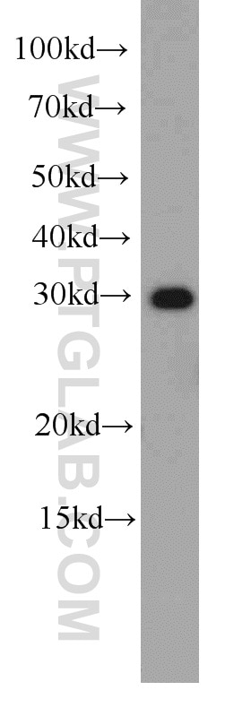 Western Blot (WB) analysis of Jurkat cells using EXOSC2 Polyclonal antibody (14805-1-AP)