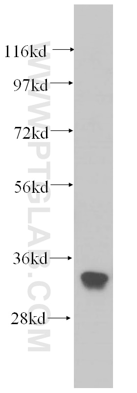 Western Blot (WB) analysis of HeLa cells using EXOSC2 Polyclonal antibody (14805-1-AP)