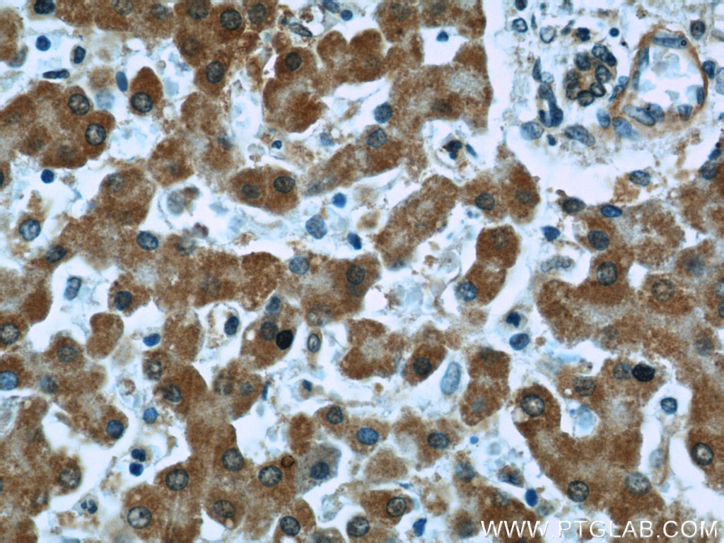 Immunohistochemistry (IHC) staining of human liver tissue using EXOSC2 Monoclonal antibody (66099-1-Ig)