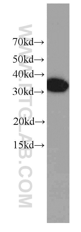 Western Blot (WB) analysis of HeLa cells using EXOSC2 Monoclonal antibody (66099-1-Ig)