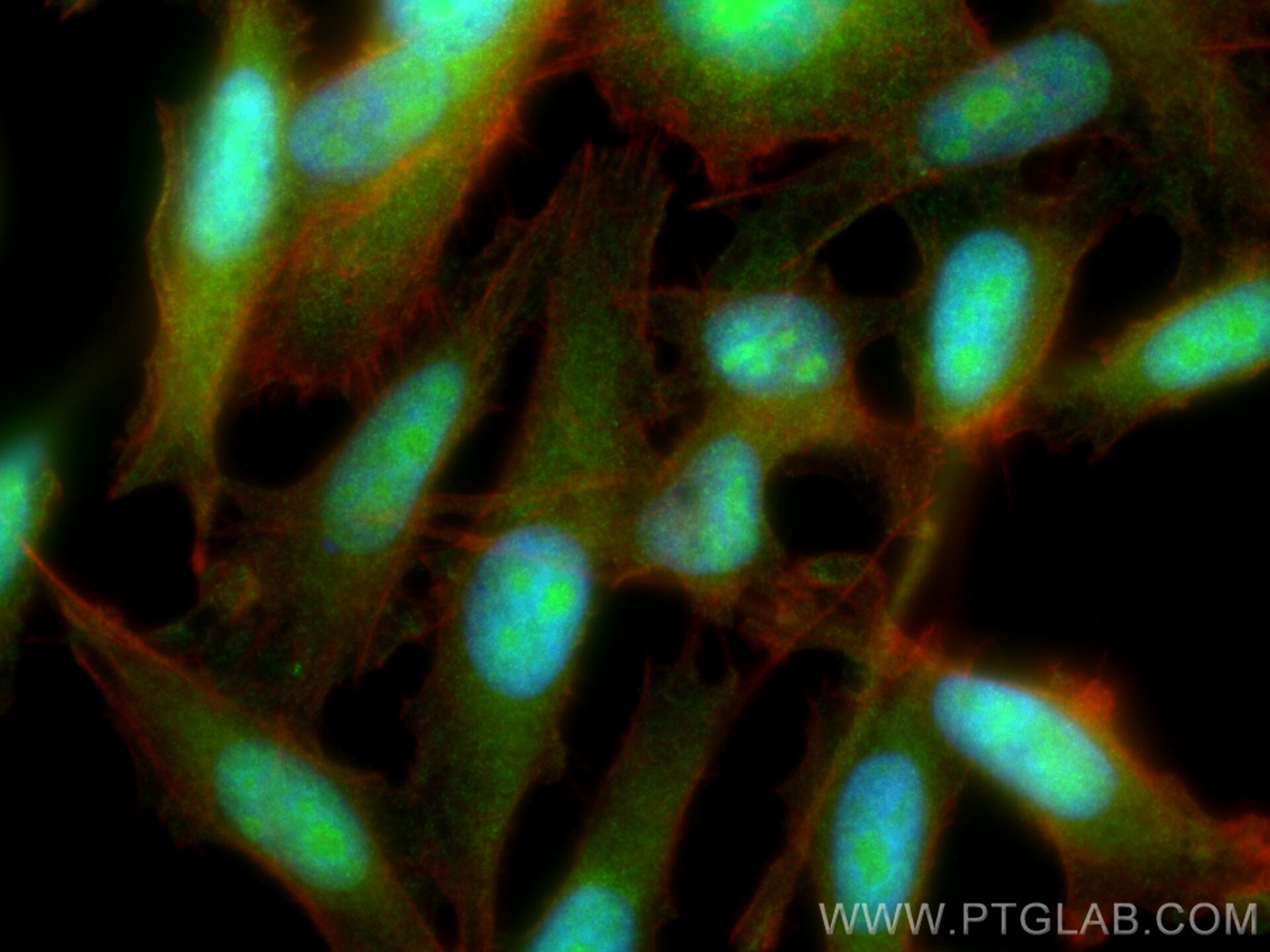 Immunofluorescence (IF) / fluorescent staining of PC-3 cells using EXOSC3 Polyclonal antibody (15062-1-AP)