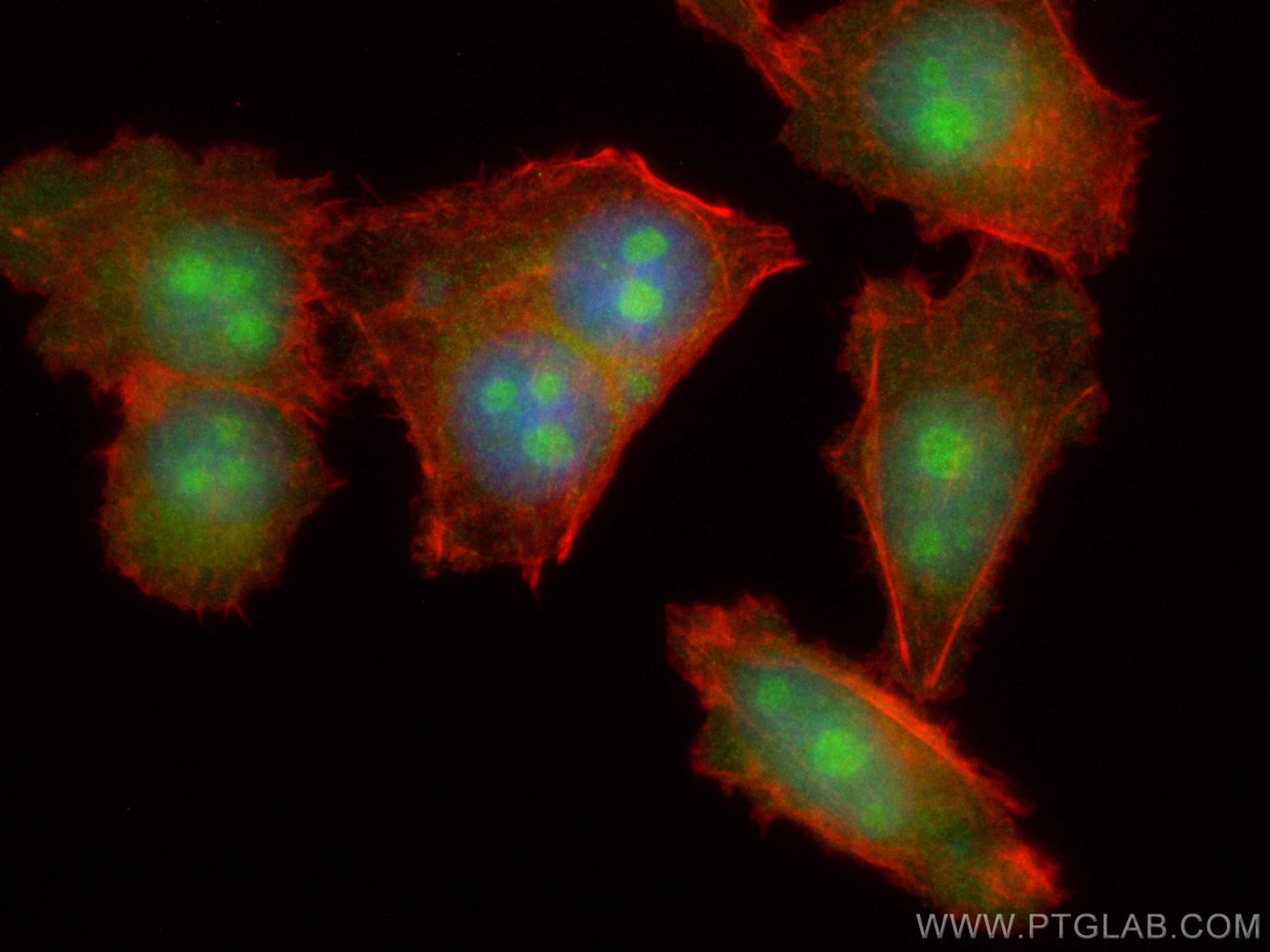 IF Staining of PC-3 using CL488-15062