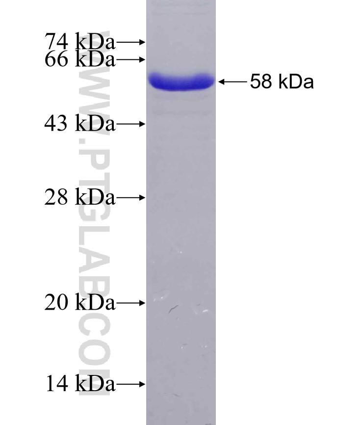 EXOSC3 fusion protein Ag7065 SDS-PAGE