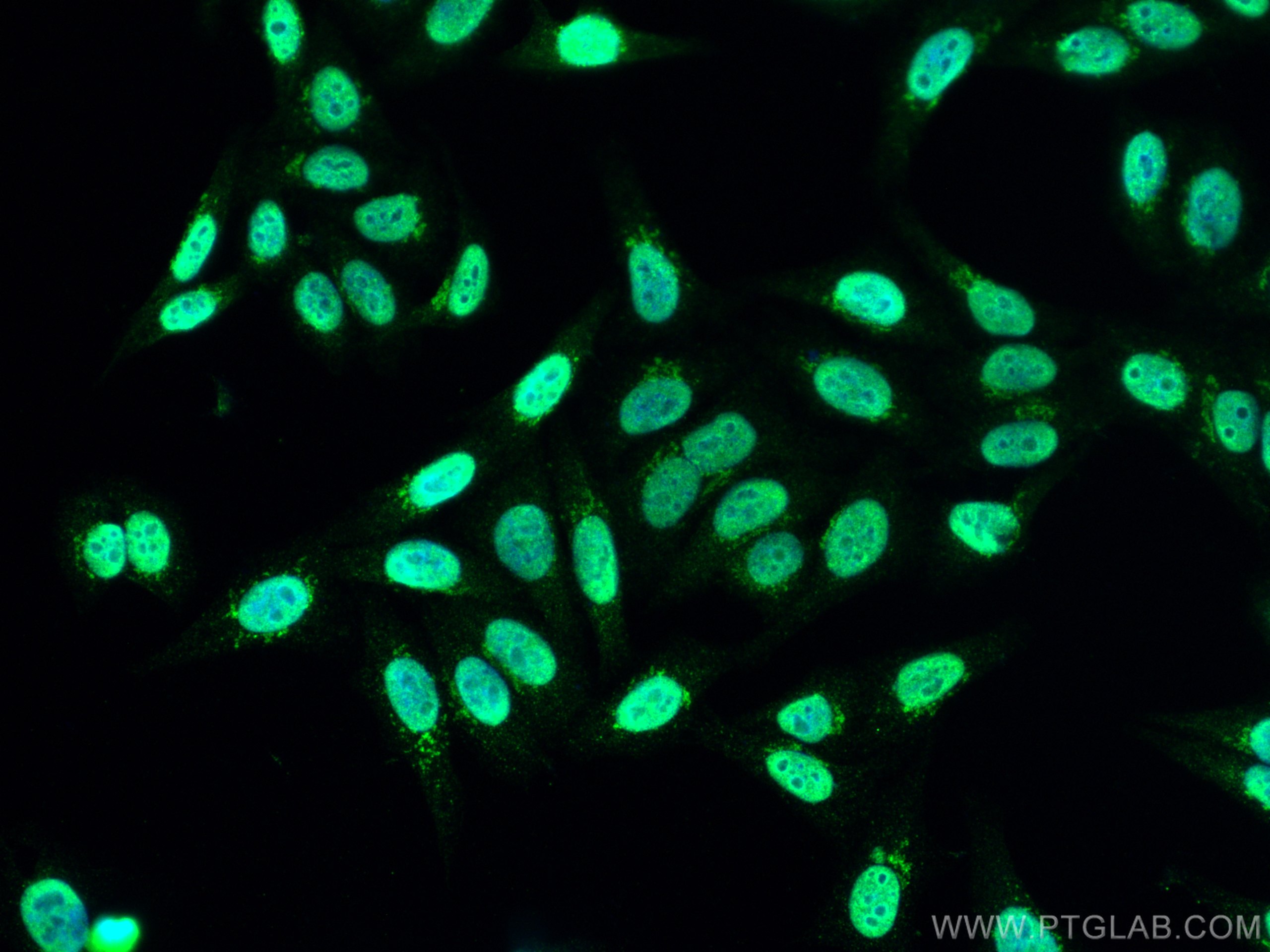 Immunofluorescence (IF) / fluorescent staining of HepG2 cells using EXOSC4 Polyclonal antibody (15937-1-AP)