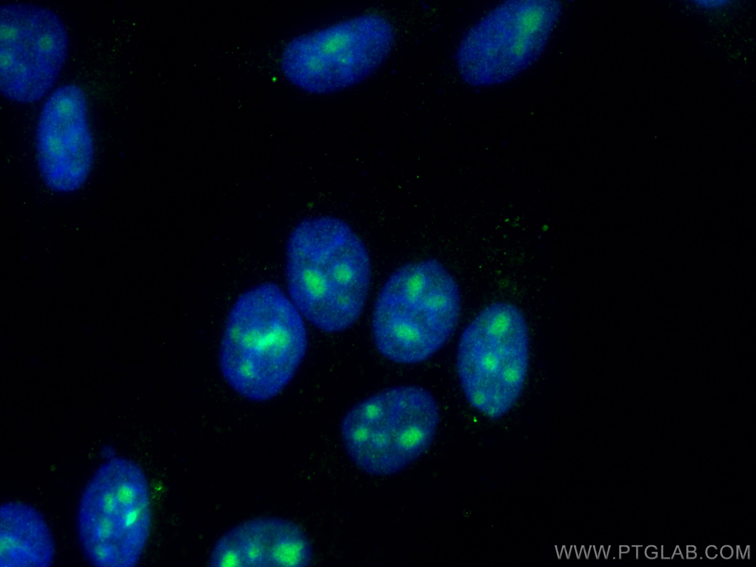 Immunofluorescence (IF) / fluorescent staining of HepG2 cells using EXOSC4 Polyclonal antibody (15937-1-AP)