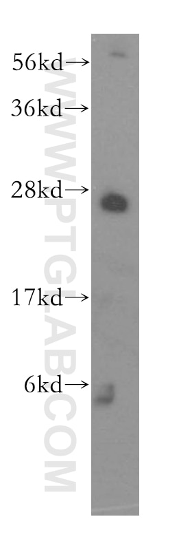 EXOSC4 Polyclonal antibody