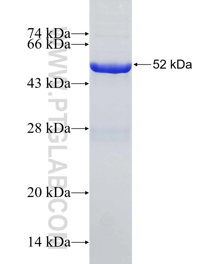 EXOSC4 fusion protein Ag7595 SDS-PAGE