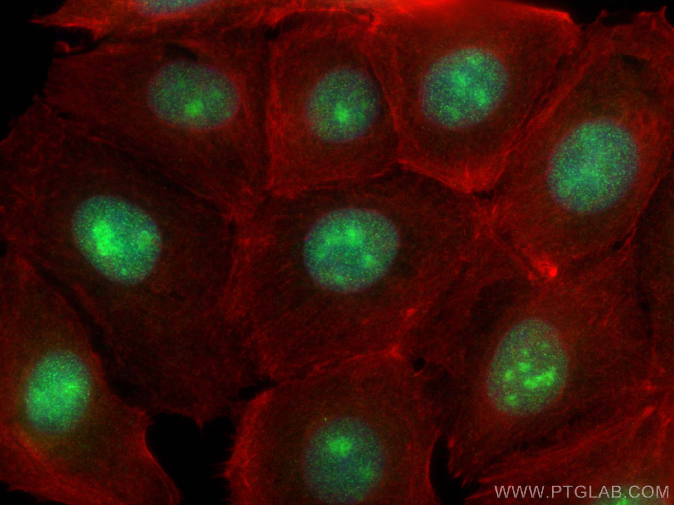 Immunofluorescence (IF) / fluorescent staining of MCF-7 cells using EXOSC5 Polyclonal antibody (15627-1-AP)