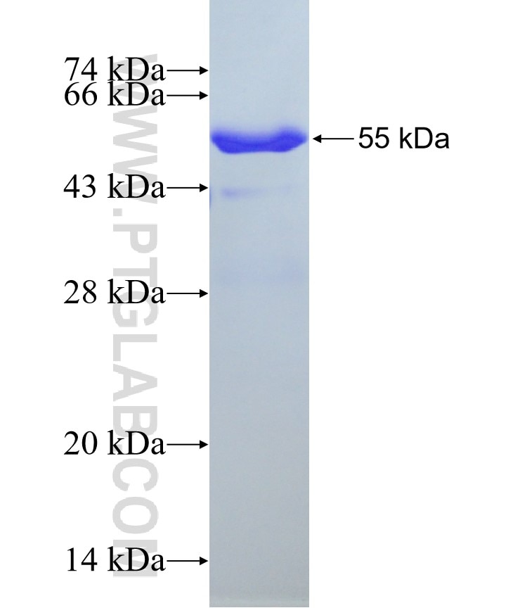 EXOSC5 fusion protein Ag8098 SDS-PAGE