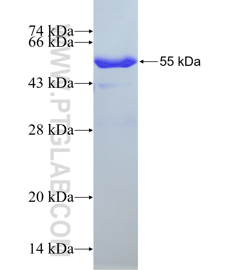EXOSC5 fusion protein Ag8098 SDS-PAGE
