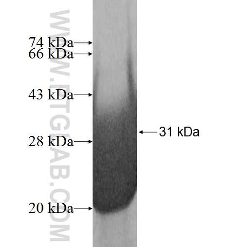 EXOSC5 fusion protein Ag8159 SDS-PAGE