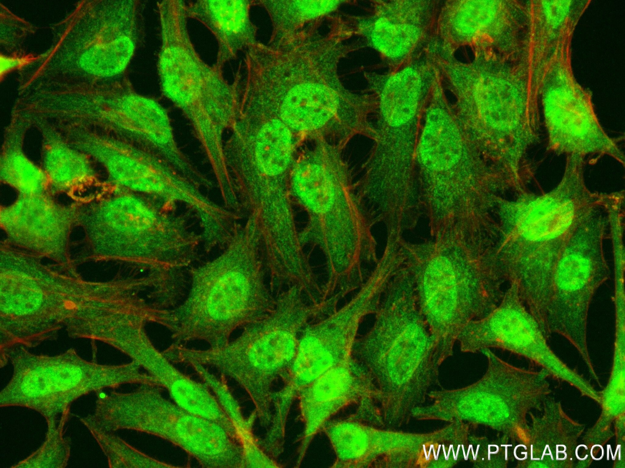 Immunofluorescence (IF) / fluorescent staining of HeLa cells using EXOSC6 Recombinant antibody (84346-2-RR)