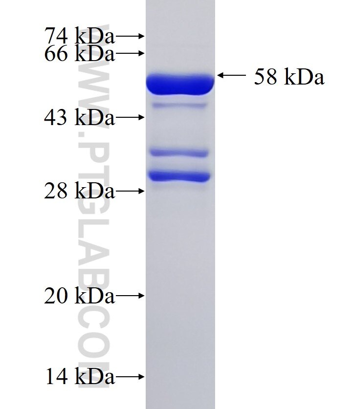 EXOSC6 fusion protein Ag33513 SDS-PAGE