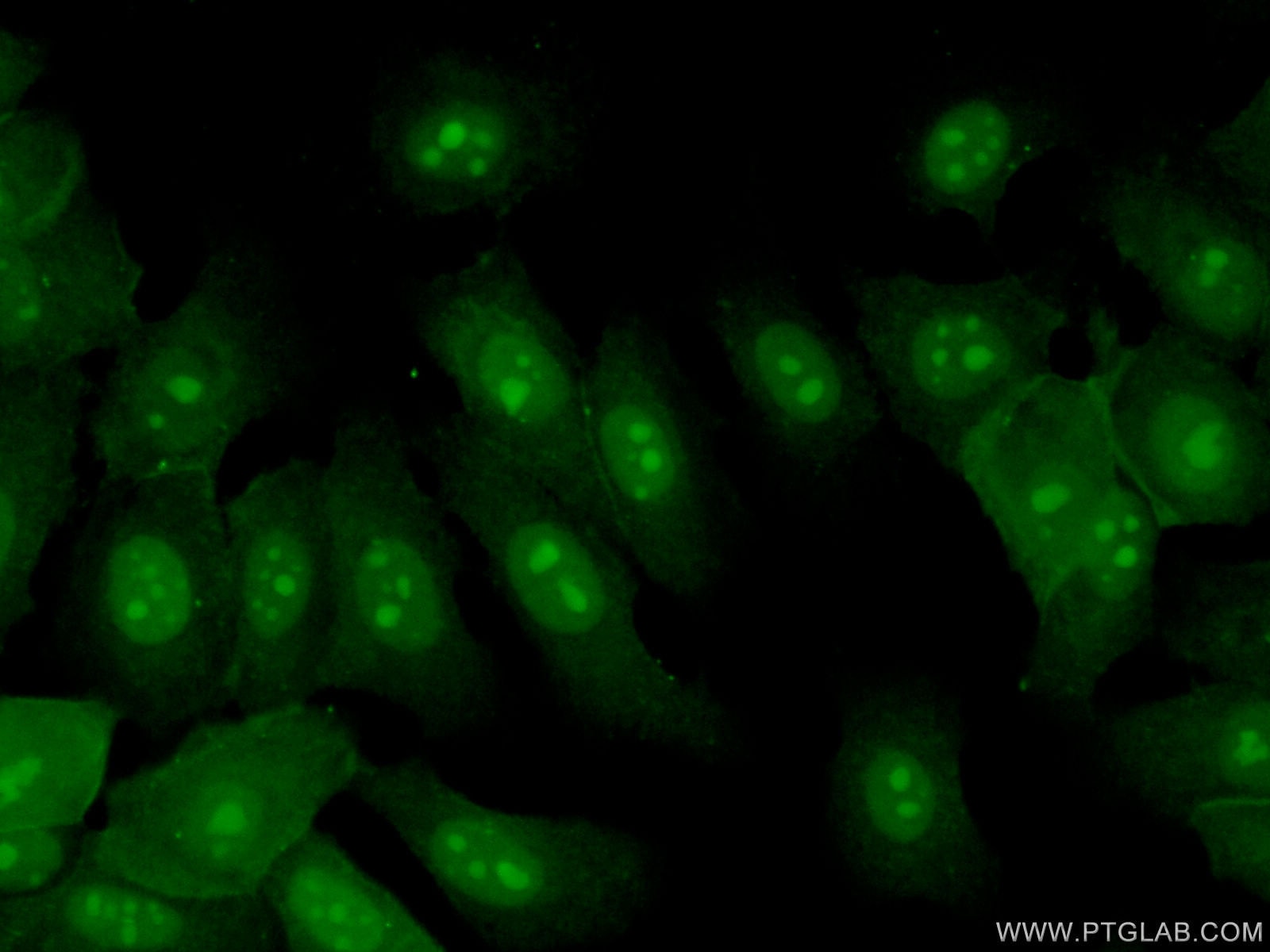 Immunofluorescence (IF) / fluorescent staining of MCF-7 cells using EXOSC7 Polyclonal antibody (25292-1-AP)