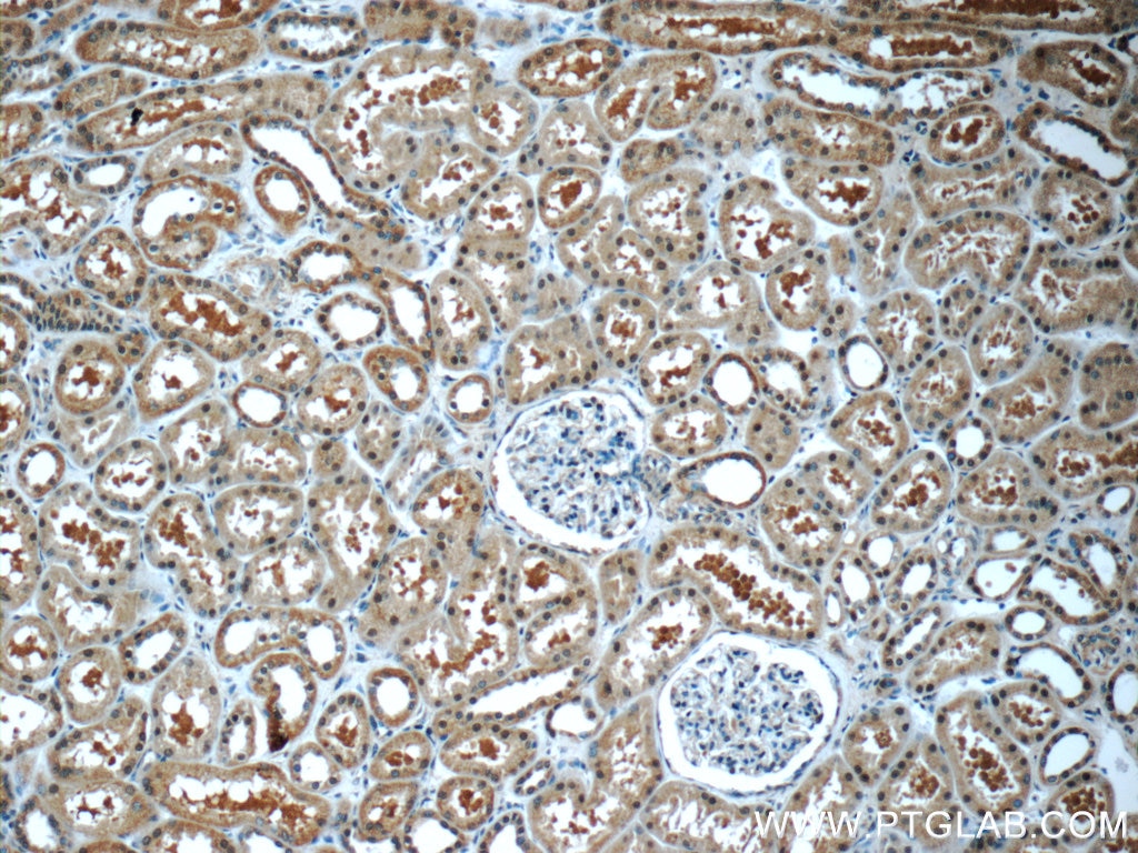 Immunohistochemistry (IHC) staining of human kidney tissue using EXOSC7 Polyclonal antibody (25292-1-AP)