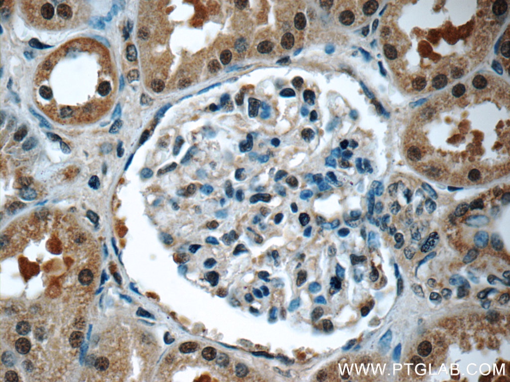 Immunohistochemistry (IHC) staining of human kidney tissue using EXOSC7 Polyclonal antibody (25292-1-AP)