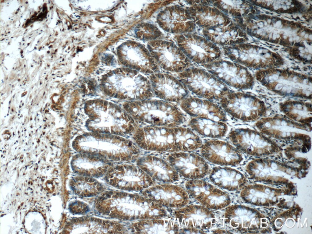 Immunohistochemistry (IHC) staining of human colon tissue using EXOSC7 Polyclonal antibody (25292-1-AP)