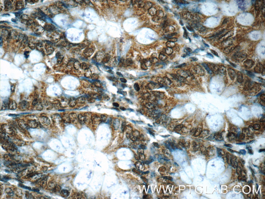 Immunohistochemistry (IHC) staining of human colon tissue using EXOSC7 Polyclonal antibody (25292-1-AP)