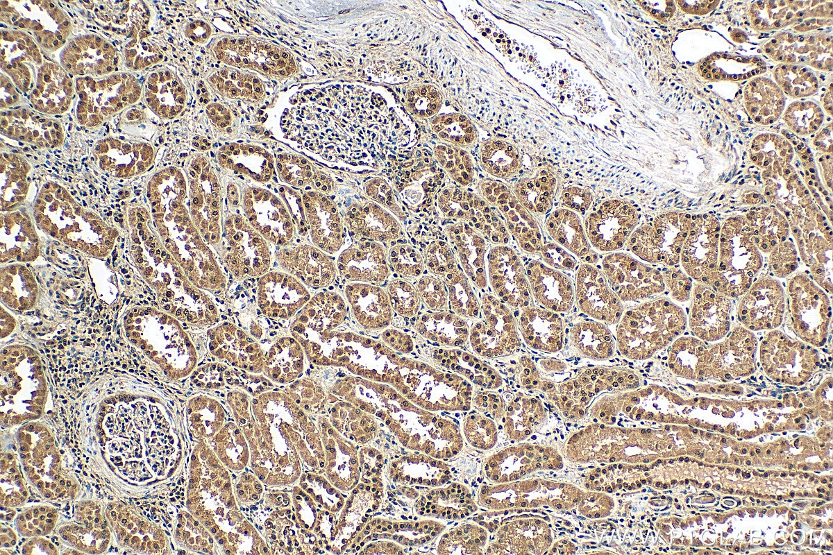 Immunohistochemistry (IHC) staining of human kidney tissue using EXOSC7 Polyclonal antibody (25292-1-AP)