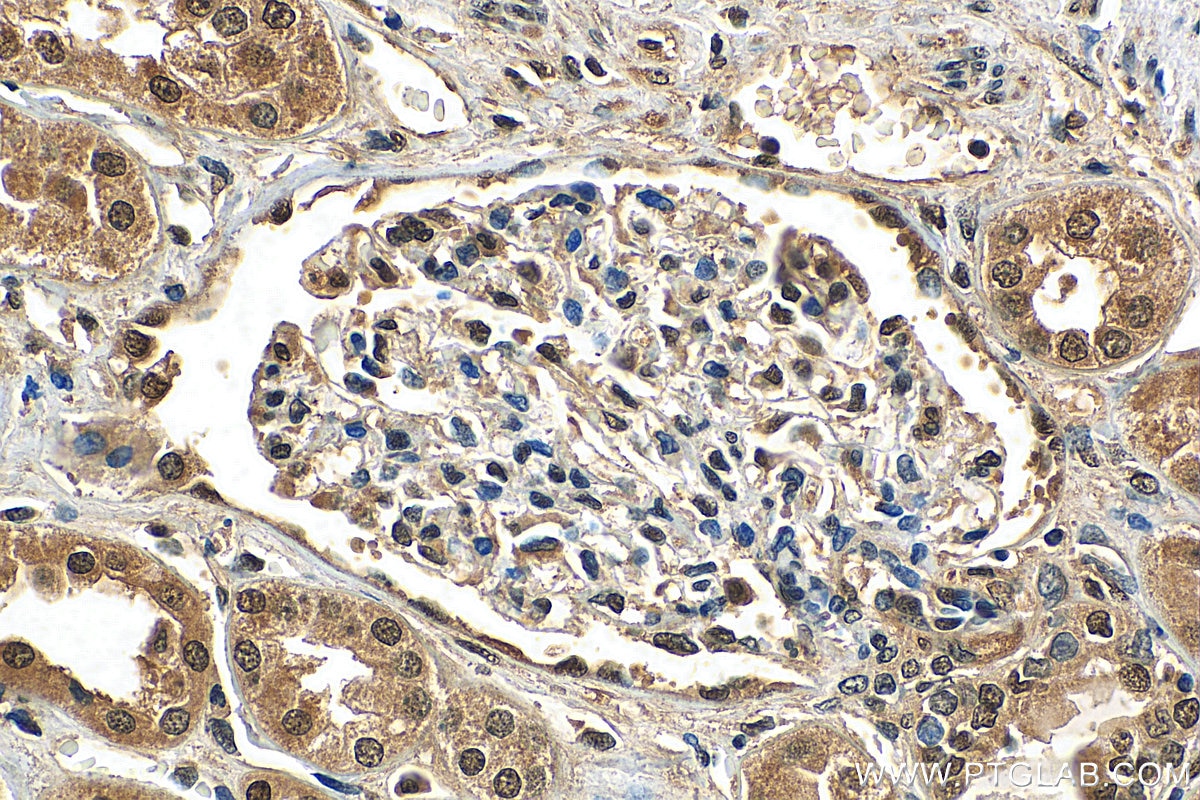 Immunohistochemistry (IHC) staining of human kidney tissue using EXOSC7 Polyclonal antibody (25292-1-AP)