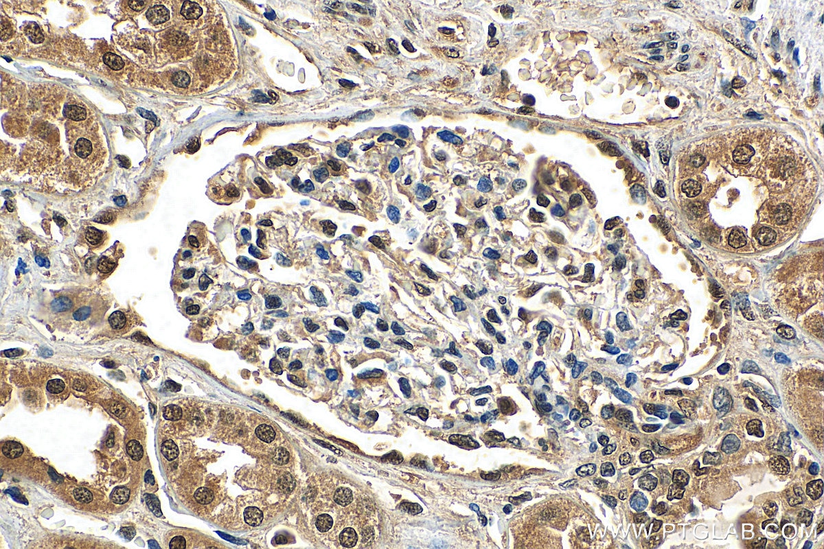 IHC staining of human kidney using 25292-1-AP