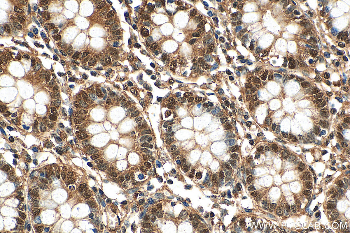 Immunohistochemistry (IHC) staining of human colon tissue using EXOSC7 Polyclonal antibody (25292-1-AP)