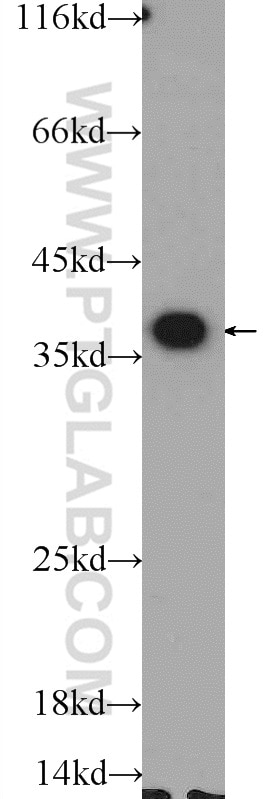 Western Blot (WB) analysis of K-562 cells using EXOSC7 Polyclonal antibody (25292-1-AP)