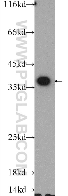 WB analysis of K-562 using 25292-1-AP