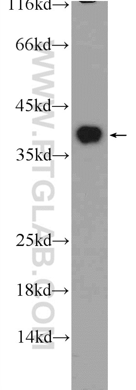 Western Blot (WB) analysis of HepG2 cells using EXOSC7 Polyclonal antibody (25292-1-AP)